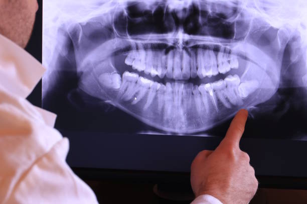 Best Emergency Dental Surgery in Kyle, SD