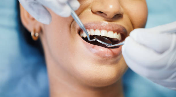 Best Emergency Root Canal Treatment in Kyle, SD